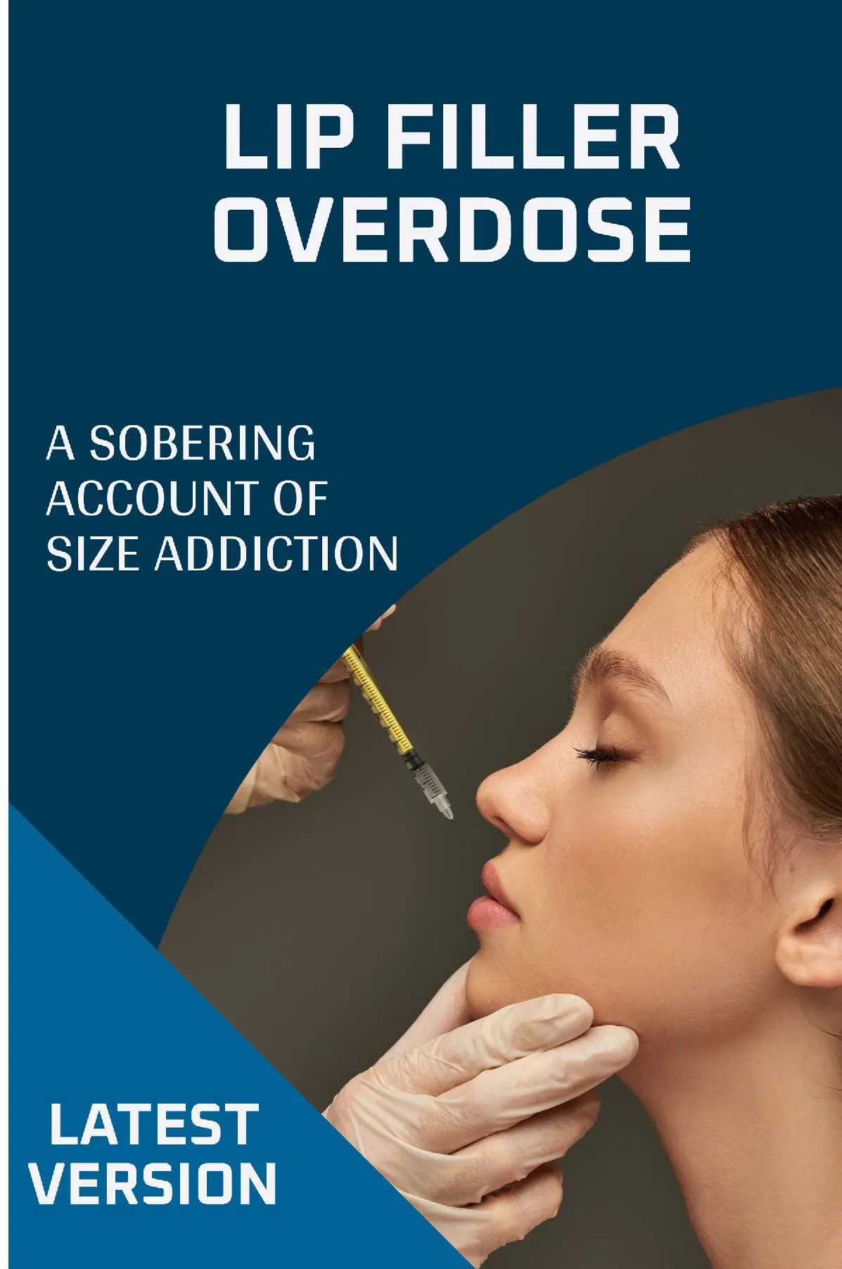Lip Filler Overdose: A Sobering Account of Size Addiction