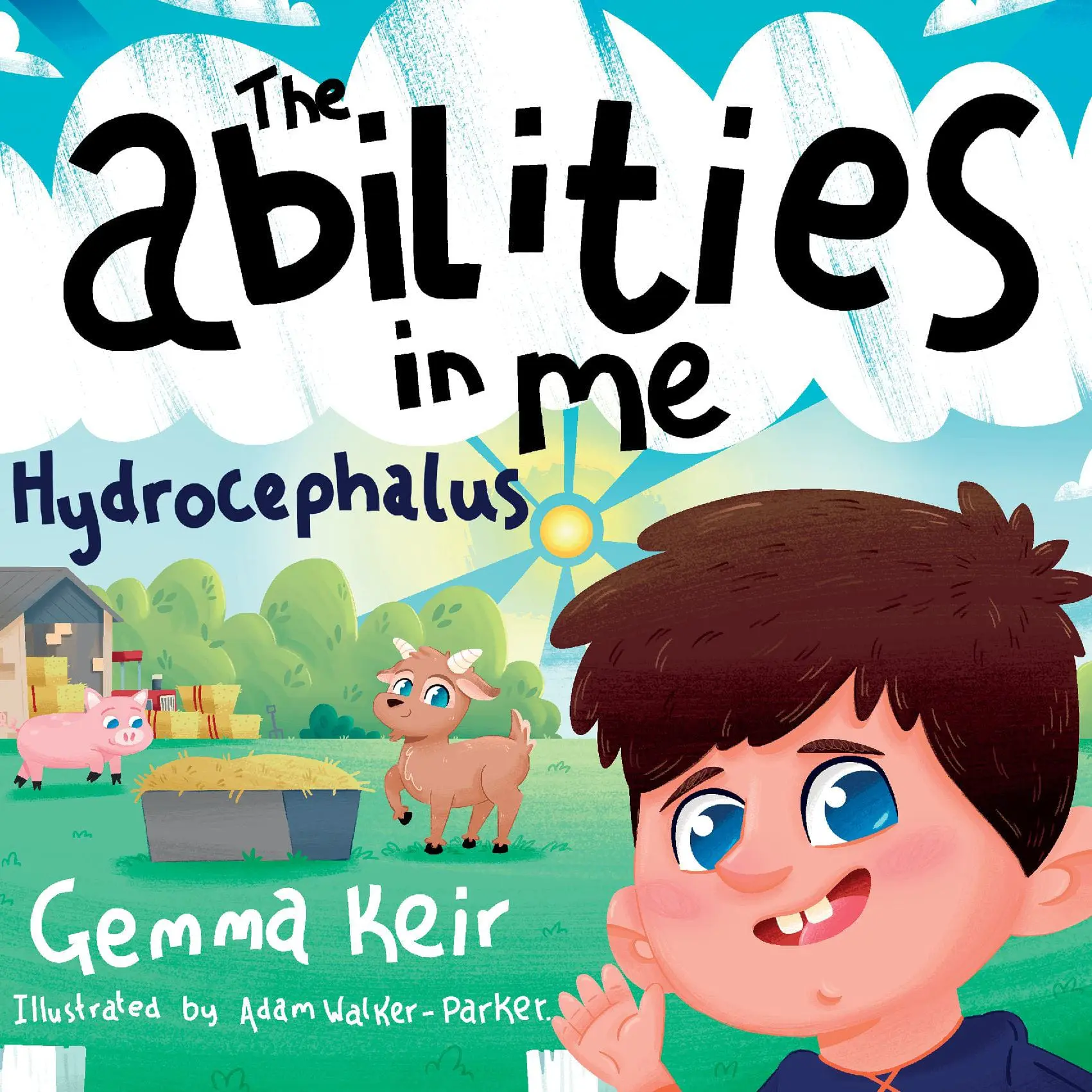The abilities in me Hydrocephalus