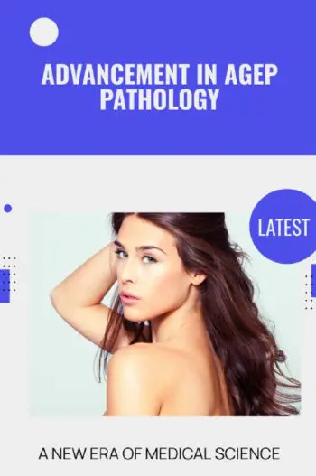 Advancement in AGEP Pathology