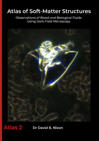 Atlas of Soft-Matter Structures: Observations of Blood and Biological Fluids Using Dark Field Microscopy (A4 Paperback Edition)