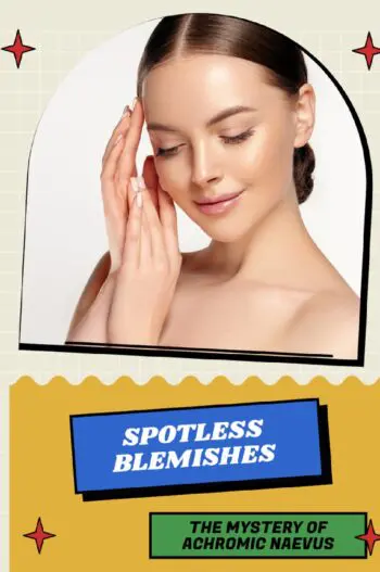 Spotless Blemishes