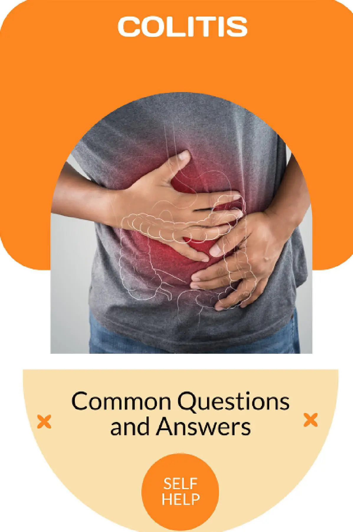 Colitis