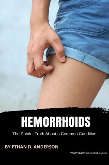 Hemorrhoids