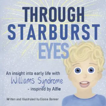 Through Starburst Eyes
