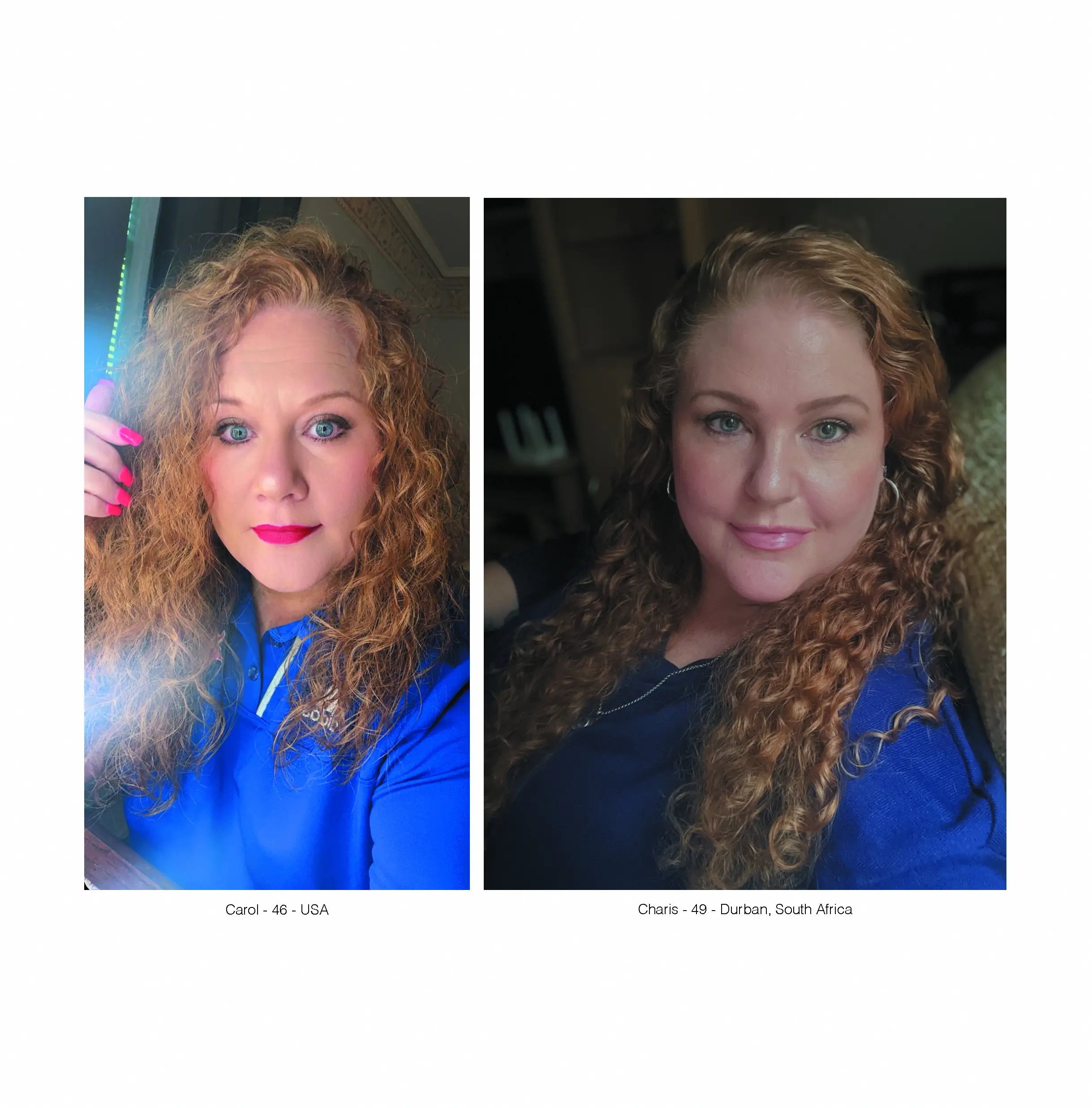 The Red Gene Project - MC1R