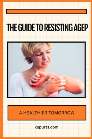 The Guide to Resisting AGEP