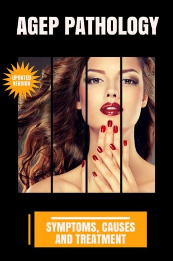 AGEP Pathology
