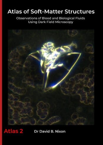 Atlas of Soft-Matter Structures: Observations of Blood and Biological Fluids Using Dark Field Microscopy (A4 Paperback Edition)