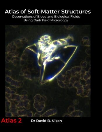 Atlas of Soft-Matter Structures: Observations of Blood and Biological Fluids Using Dark Field Microscopy (USL Hardcover Edition)