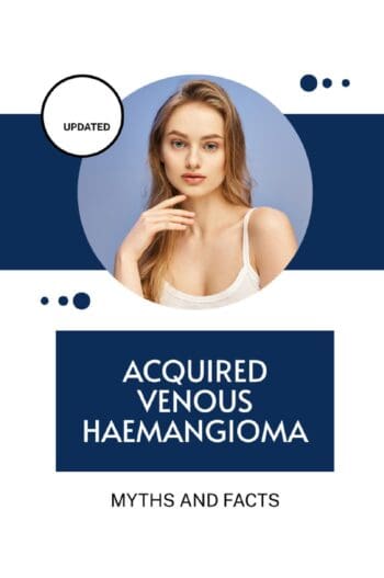 Acquired Venous Haemangioma