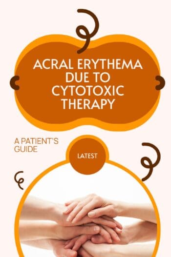 Acral Erythema Due to Cytotoxic Therapy
