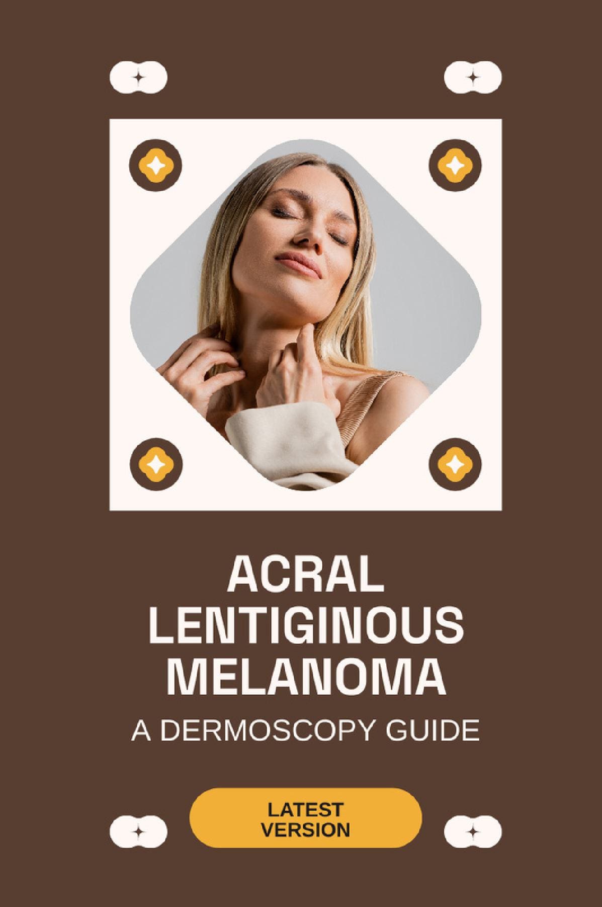 Acral Lentiginous Melanoma