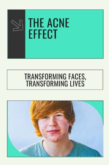 The Acne Effect