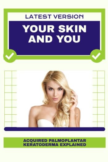 Your Skin And You