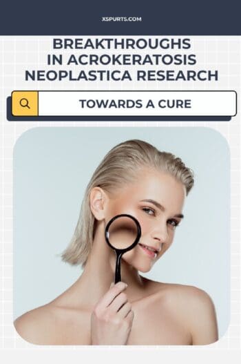 Breakthroughs in Acrokeratosis Neoplastica Research