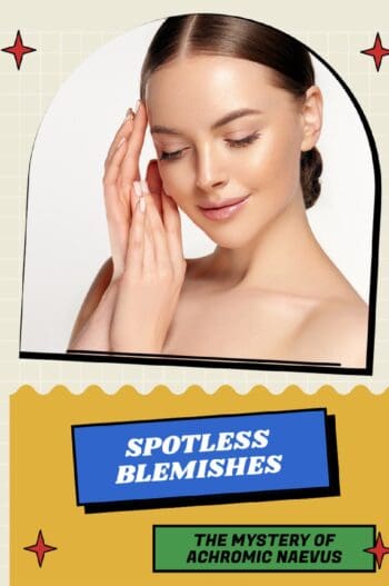 Spotless Blemishes