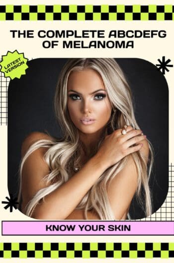 The Complete ABCDEFG of Melanoma