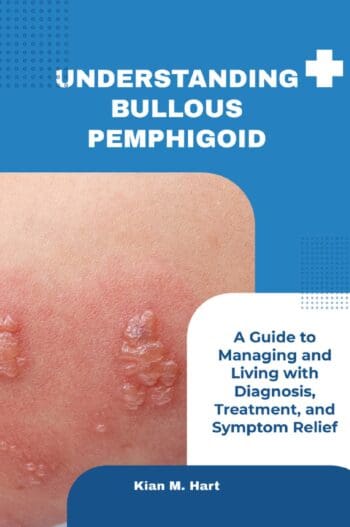 Understanding Bullous Pemphigoid