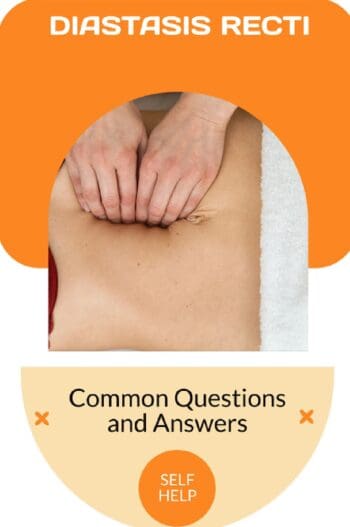 Diastasis Recti