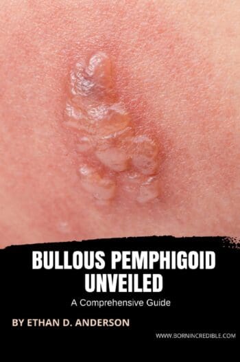 Bullous Pemphigoid Unveiled