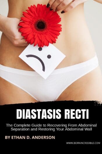 Diastasis Recti