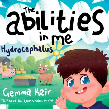 The abilities in me Hydrocephalus